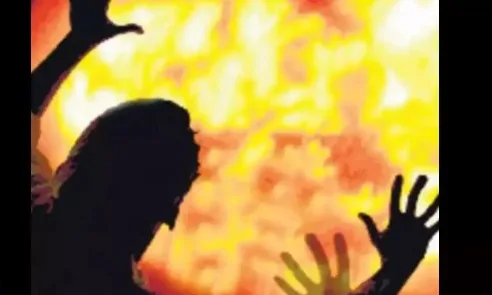 ससुराल में पत्नी से कहासुनी के बाद युवक ने खुद को आग लगाई, गंभीर